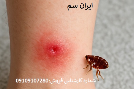 نابودی کک با سم بایر آلمان
